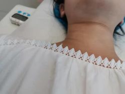 体验后-西安伊美尔医疗美容医院