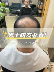 -极客侠·AI定制假发补发
