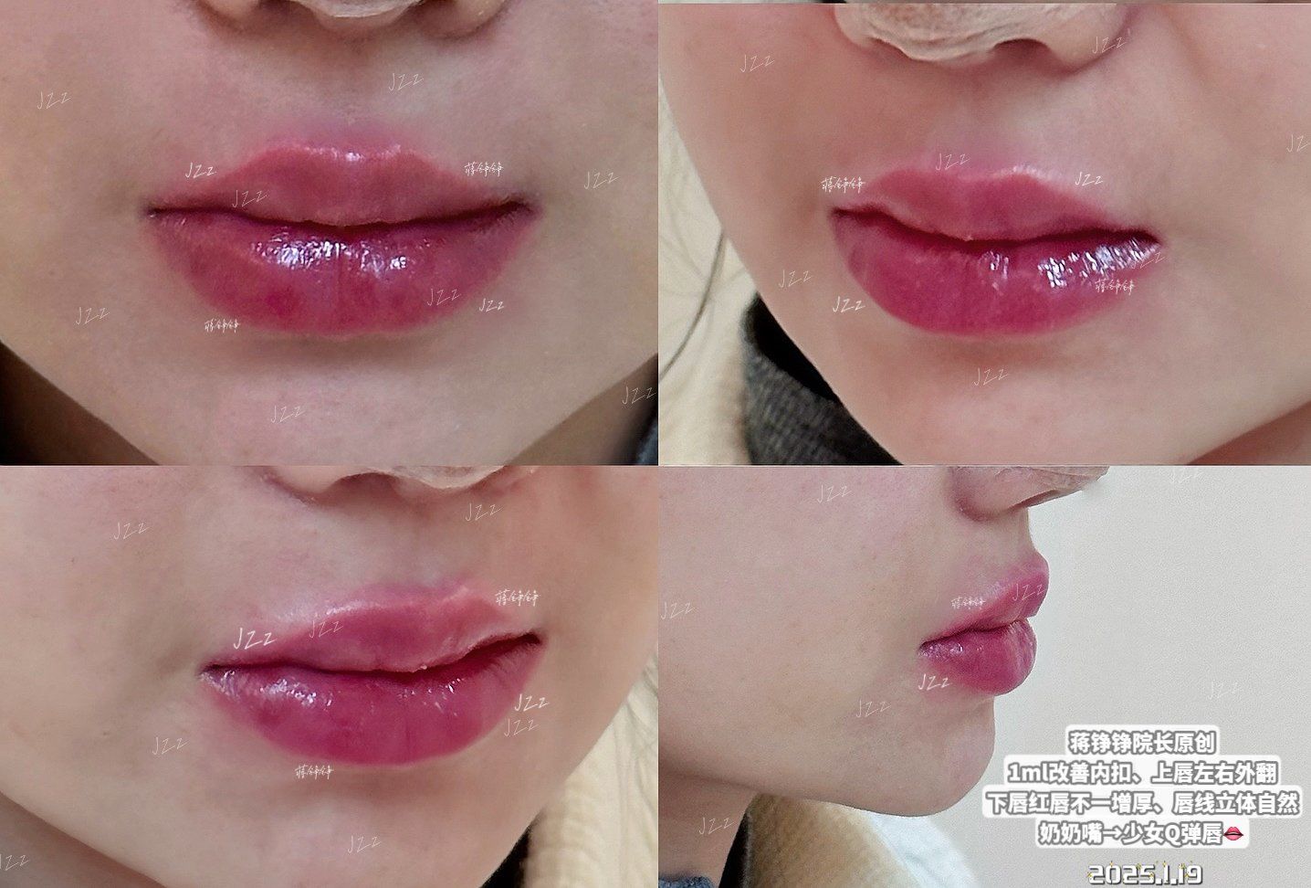 这个魅力果冻唇,真没人管管吗❓