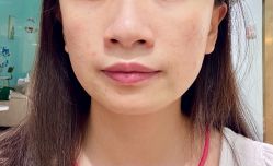 体验后-上海玫瑰医疗美容医院