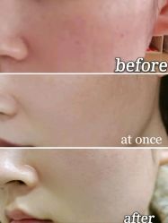 体验前-八大处整形