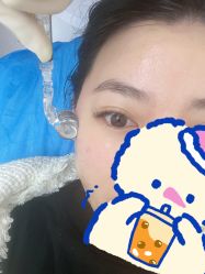 体验后-丽美妍医疗美容·皮秒·立体分层抗衰