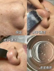 -春田皮肤管理中心品牌旗舰店