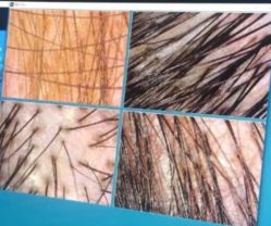 -雍禾植发全国连锁