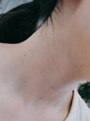 -美瑞莎创美医疗美容