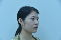 体验前-Yestar艺星整形美容医院