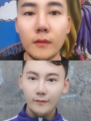-成都西区医院整形美容