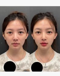 -上海伊莱美医疗美容医院