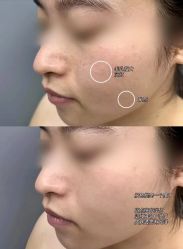 -深圳艺星医疗美容医院