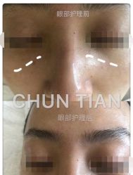 -春田皮肤管理中心品牌旗舰店