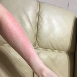 体验后-深圳广和门诊部·整形医疗美容