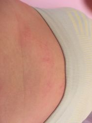 -香薇妮丝女子减肥院