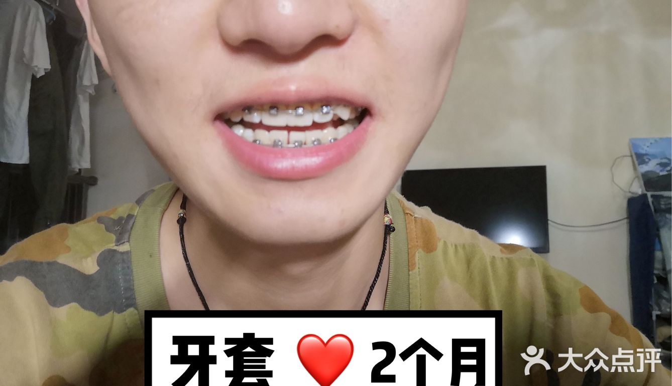 【案例分享】今天我们来讲个小帅哥的正畸案例