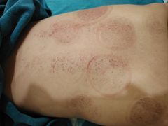 -艾通康缘艾灸.疼痛.睡眠养生馆(凤凰城店)