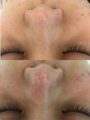 -佳慕祛痘皮肤管理连锁