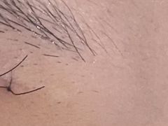 -上海市皮肤病医院(武夷路院区)