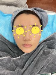 体验后-澳尔颜选医疗美容
