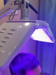 -碧莲盛·不剃发植发