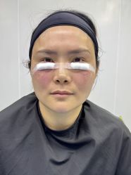-广州健丽·去眼袋医疗美容机构