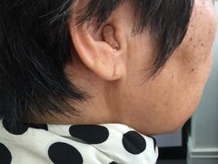 宝山瑞声达隐形助听器-宁耳听力助听器奥迪康·峰力·西门子(宝山店)