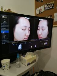 -博乐达水杨酸祛痘皮肤管理中心