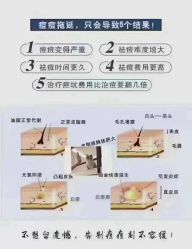 -蕾特恩专业祛痘·皮肤管理