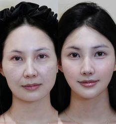 点击看大图 -Yestar艺星医疗美容医院