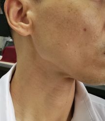 -北京美痣堂古方祛痣斑疣瘊