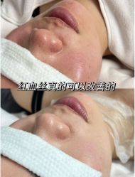 -上海伊莱美医疗美容医院