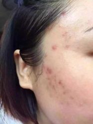 英树玻尿酸羊胎素化妆品-英树玻尿酸羊胎素专营化妆品