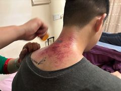 -沈师傅盲人按摩工作室(密三小区店)