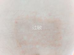 -上海市黄浦区香山中医医院