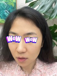 体验前-北京楚诺医疗美容