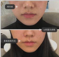 -上海漾颜医疗美容