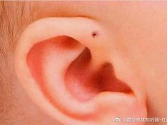 -惠耳听力助听器(霍邱新蓼大道店)