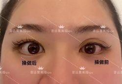 -LUNA皮相美·骨相美高级美感