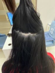 -大麦微针植发丨全国连锁