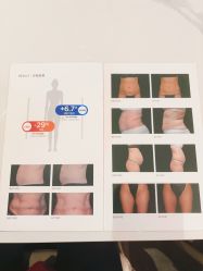 -Fundi张玉珊修身堂·indiba·BTL科技瘦身