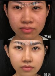 -北京米扬丽格医疗美容·联合丽格鼻整形中心