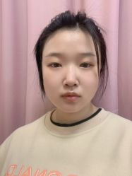 体验后-西安现代妇产医院医疗美容