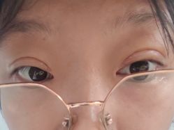 -八大处整形