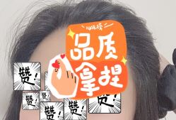 -大麦微针植发全国连锁