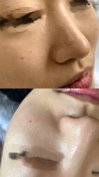 -LUNA皮相美·骨相美高级美感