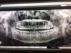 -深圳佑诺口腔门诊部