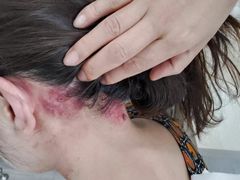 -名医堂永康中医·推拿正骨·针灸·艾灸