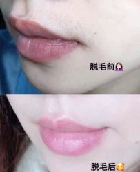 -DMK酶疗中心·BeautyYoung舒妍科技美肤
