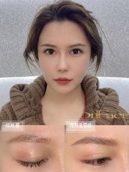-OnFaer.纹眉半永久无创洗眉