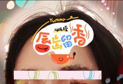 -大麦微针植发全国连锁