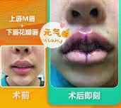 -SKINIST丽铂医疗美容