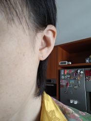 -应超小李飞刀整形